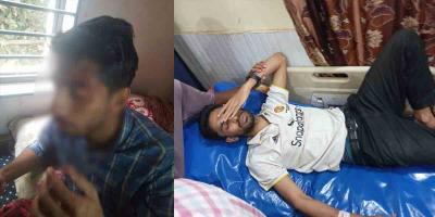 চৌদ্দগ্রামে জামায়াত আমিরের সমাবেশ শেষে সংঘর্ষ, আহত ১০