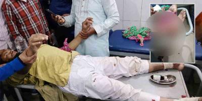 গজারিয়ায় প্রতিপক্ষের হামলায় গুলিবিদ্ধসহ আহত ২