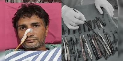অসহ্য ক্ষুধায় খেয়েছেন ২৯ চামচ, ১৯ টুথব্রাশ ও ২ কলম!